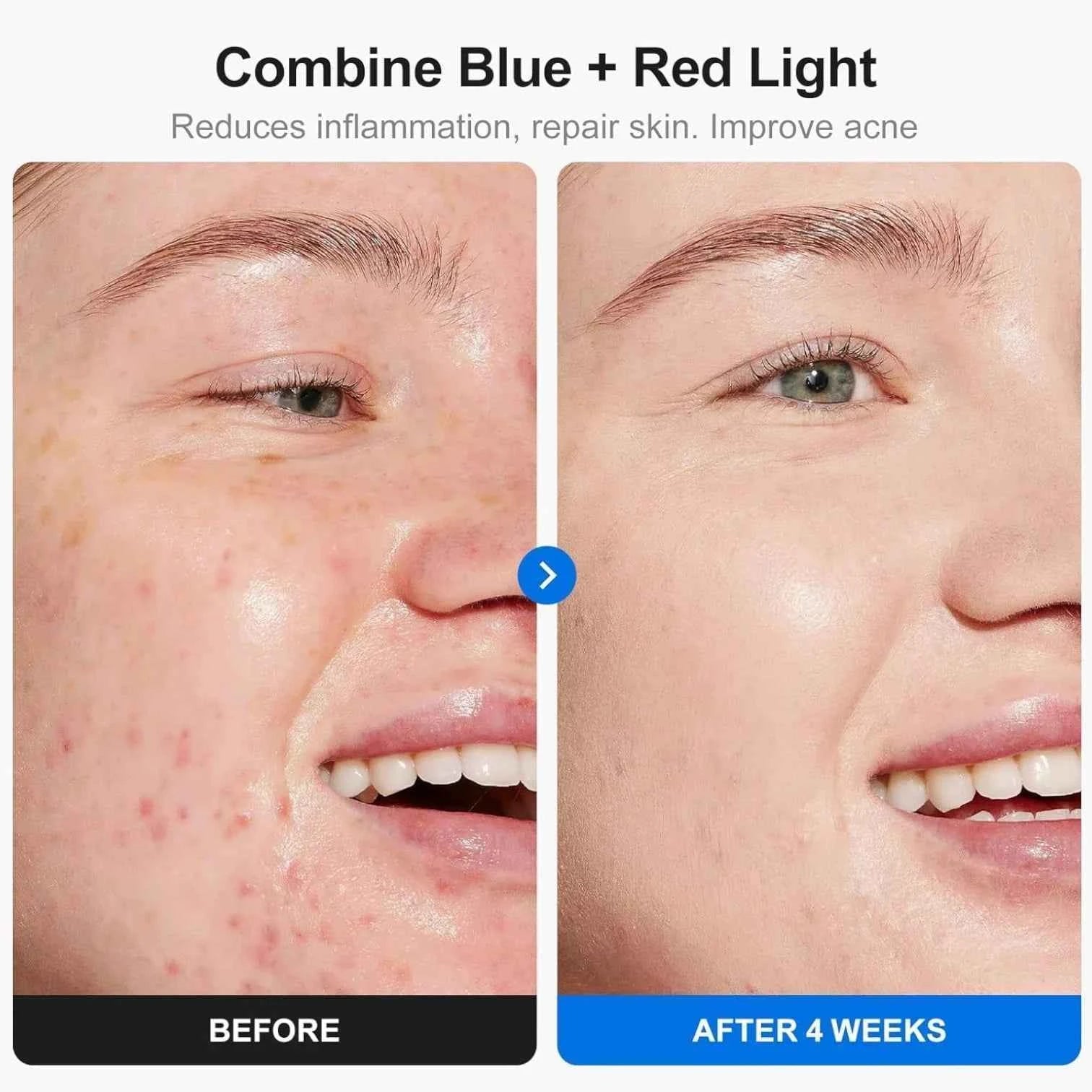 LED Facial Mask 7 Color Light Therapy Rechargeable With Remote Control