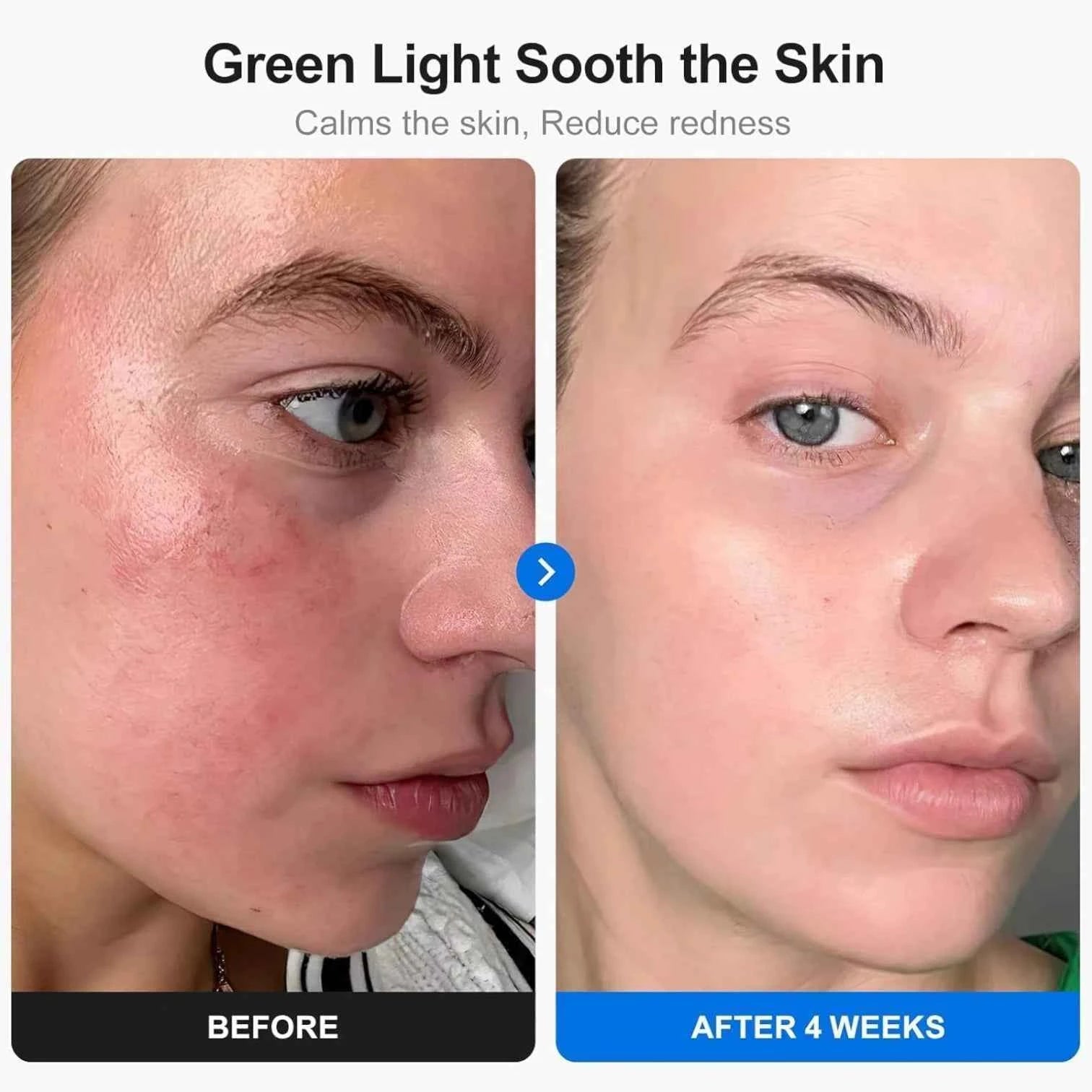 LED Facial Mask 7 Color Light Therapy Rechargeable With Remote Control