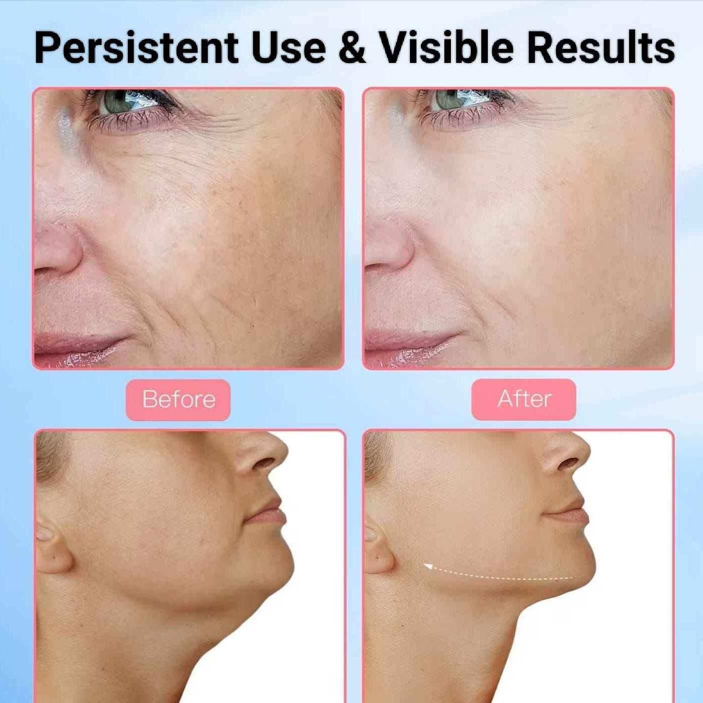 Face and Neck Massager Light Therapy for Skin Rejuvenation, Firming & Lifting