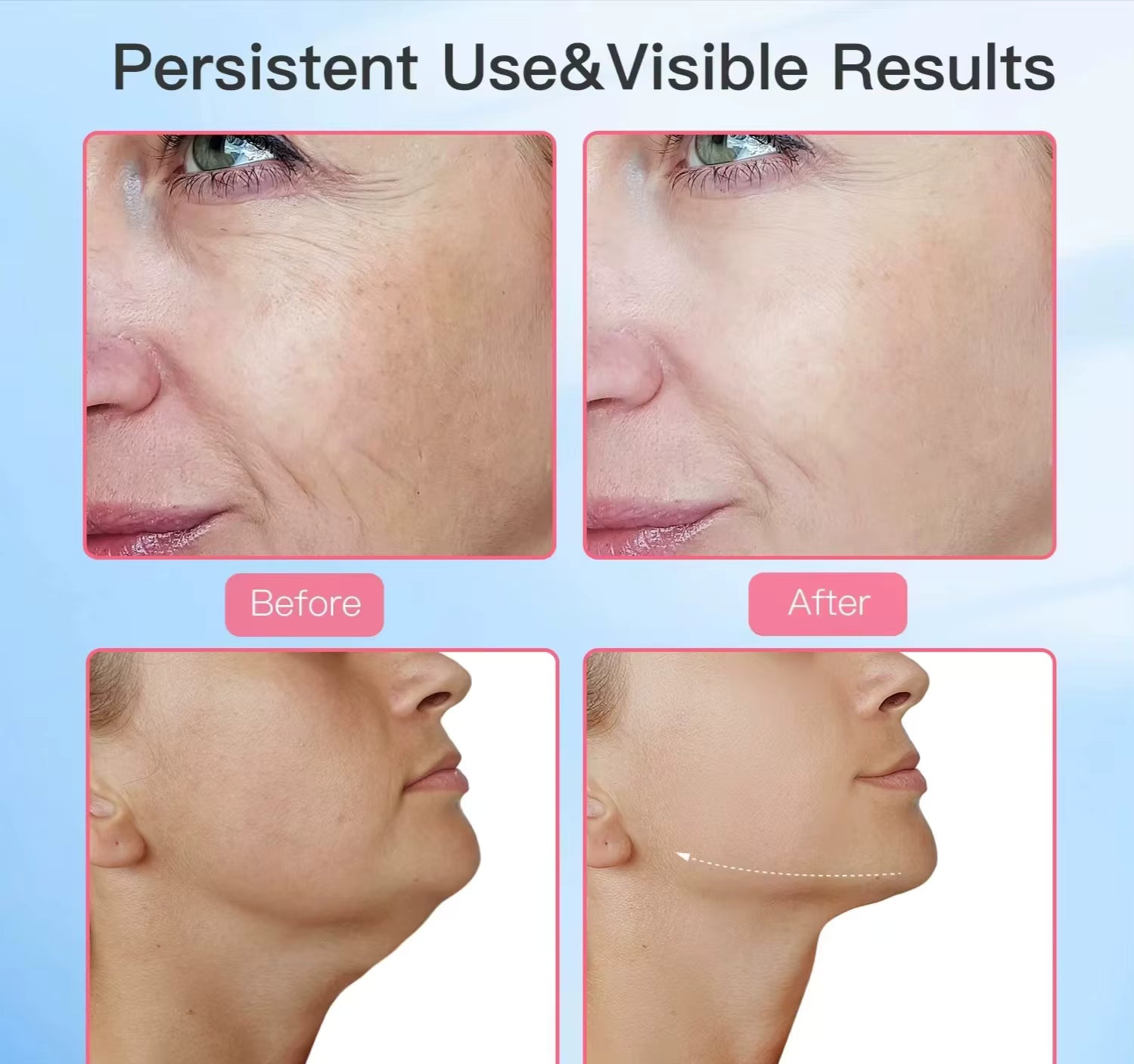 3-in-1 LED Light Therapy Neck & Face Massager - Skin Rejuvenation, Firming & Lifting