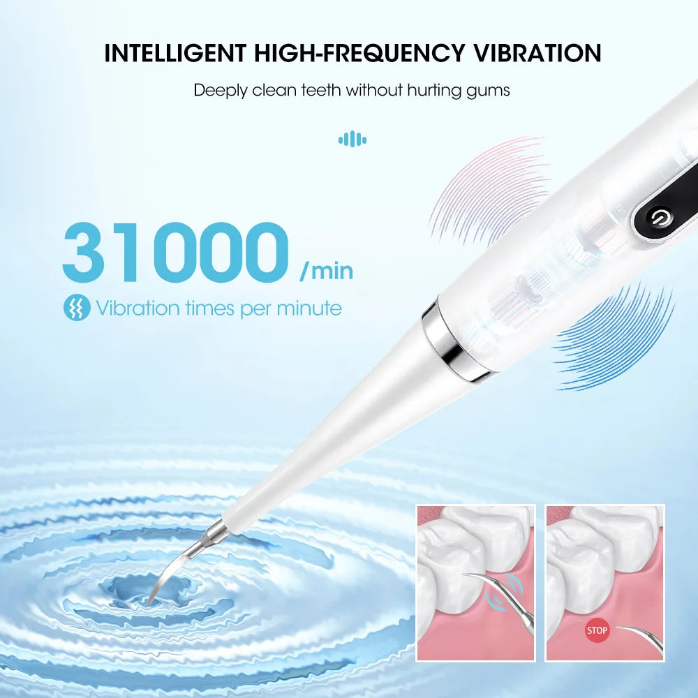 Sonic 2-in-1 Electric Oral Hygiene Kit with Scaler and Toothbrush for Deep Cleaning - Tartar, Plaque, and Stain Removal